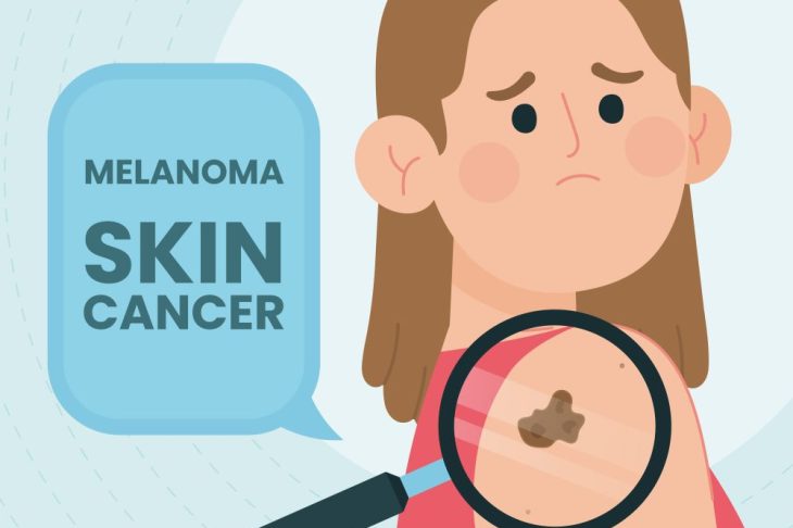 Early Signs of Melanoma You Shouldn’t Ignore: Dermatologists Explain