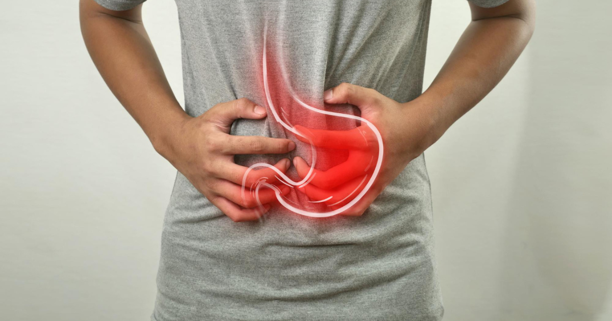Stomach Cancer Symptoms, Causes, and Treatments: A Clear Guide