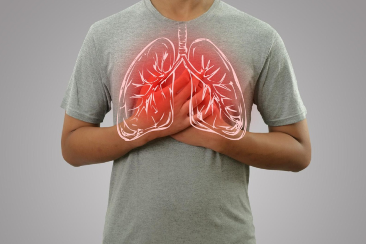 Why Are More Non-Smokers Being Diagnosed with Lung Cancer?