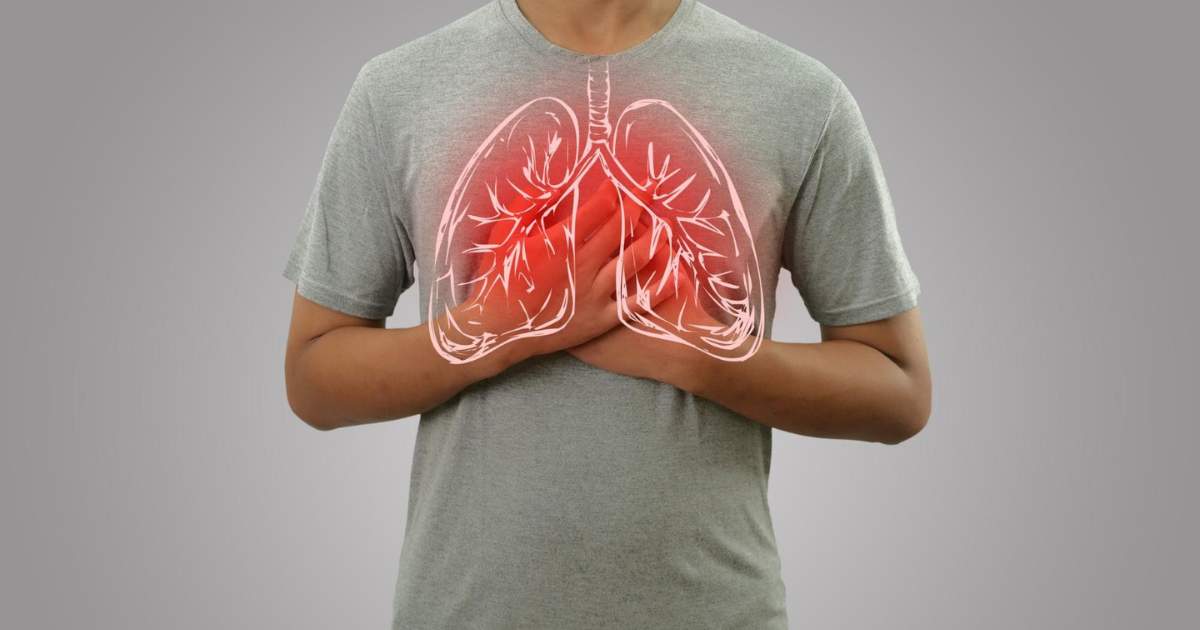 Lung cancer in non-smokers and common risk factors