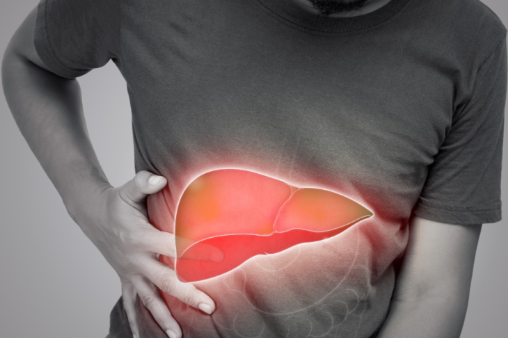 Fatty Liver and Liver Cancer: Is There a Connection?