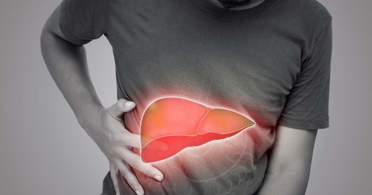 Fatty Liver and Liver Cancer: Is There a Connection?