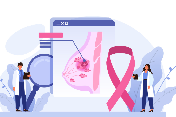Breast Lump: Is It a Fibroadenoma or Breast Cancer? Here Is How to Tell